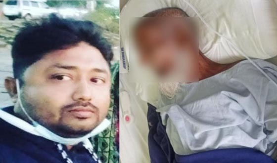রামুতে ছেলের গুলিতে পিতার মৃত্যু, এলাকায় চাঞ্চল্য