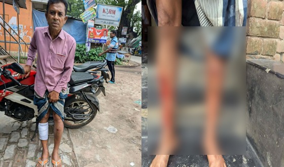 কালীগঞ্জে চাঁদা না দেওয়ায় এক ব্যাক্তিকে কুপিয়ে জখম