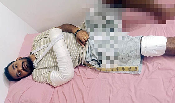 ইতালিতে উচ্ছৃঙ্খল যুবকদের আক্রমণের শিকার বাংলাদেশী যুবক