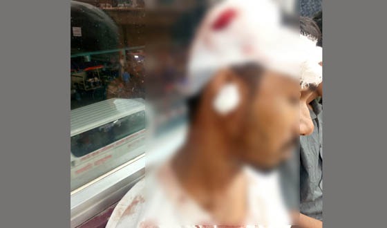 দুপুরে হুমকি, বিকেলে হত্যার উদ্দেশ্যে হামলা