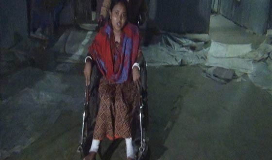 যৌতুকের জন্য গৃহবধূর দু’পা ভেঙে দিল পাষণ্ড স্বামী