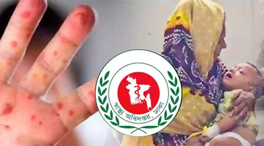 সিলেটে হামের উপসর্গে ২৪ ঘণ্টায় আরও ৩ শিশুর মৃত্যু, মোট মৃত্যু ৭২
