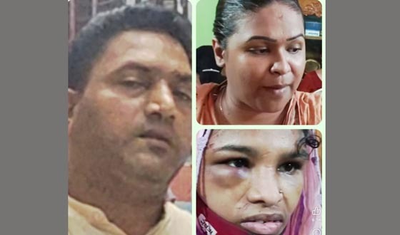 খুলনায় গৃহকর্মী নির্যাতনে গ্রেফতার পুলিশ-দম্পতি