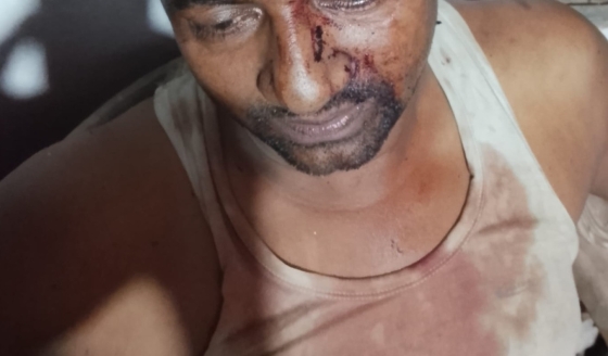 বাগমারায় দোকানিকে ধাওয়া করে গুলির অভিযোগ