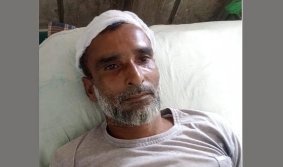 আশাশুনিতে প্রতিপক্ষের হামলায় শিশুসহ আহত ৪