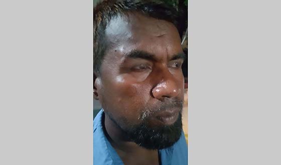 অভয়নগরে বিদ্যুৎ উপকেন্দ্রে হামলা, আহত ১