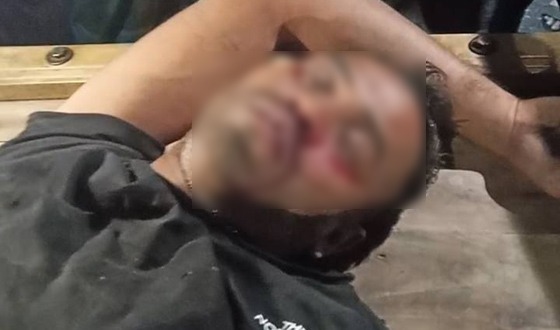 মোটরসাইকেল চোরকে আটক করে গণধোলাই