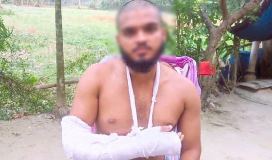 বোরহানউদ্দিনে ফুটবল খেলাকে কেন্দ্র করে যুবক কে পিটিয়ে আহত