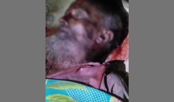 হোসেনপুরে ছুরিকাঘাতে বৃদ্ধের মৃত্যু, আটক ৩