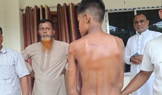 পাংশায় শিক্ষকের বেত্রাঘাতে হাসপাতালে ছাত্র, অবরুদ্ধ শিক্ষক