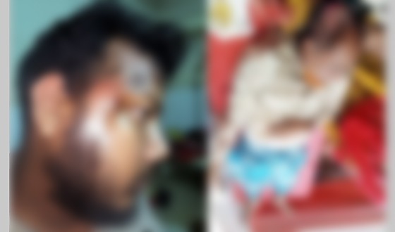 রায়গঞ্জে জমি নিয়ে বিরোধ: সংঘর্ষে আহত ৫