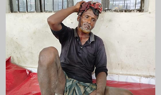 কিশোরী মেয়েকে উত্যাক্ত করার ক্ষোভে ৪ জনের মাথা ফাটালেন বাবা