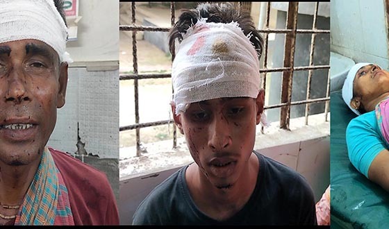 মান্দায় প্রতিপক্ষের মারধরে নারীসহ তিন জন আহত