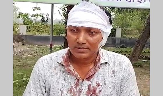 মান্দায় মাদকসেবীর হামলায় স্কুলশিক্ষক গুরুতর আহত