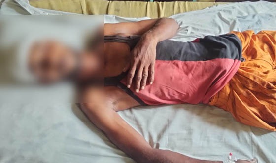 দাকোপে ঘের দখলের বিরোধে আহত ৫