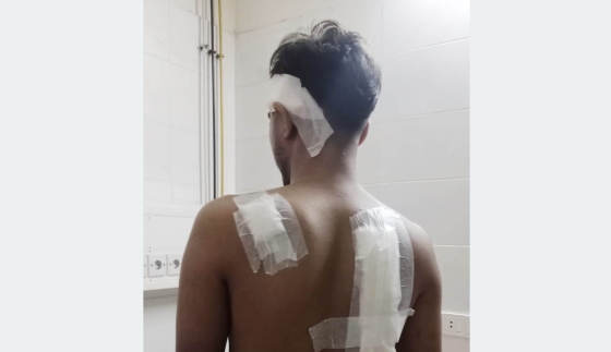 জয়দেবপুর বাজারে  সন্ত্রাসী হামলায় আহত সাংবাদিক পুত্র সাকিব