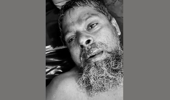 শৈলকুপায় হামলা চালিয়ে ইজিবাইক ছিনতাই