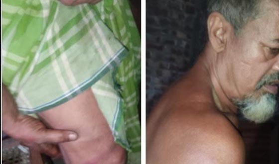 চাঁদা না দেয়ায় বসতবাড়িতে হামলা, লুটপাট, মারধরে আহত ৪