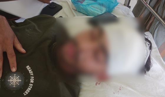 আধিপত্য বিস্তার নিয়ে হামলা, ভাঙচুর ও লুটপাটের অভিযোগ