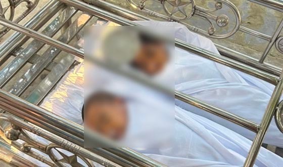 সাঁথিয়ায় ভিমরুলের কামড়ে প্রাণ গেল ২ শিশুর