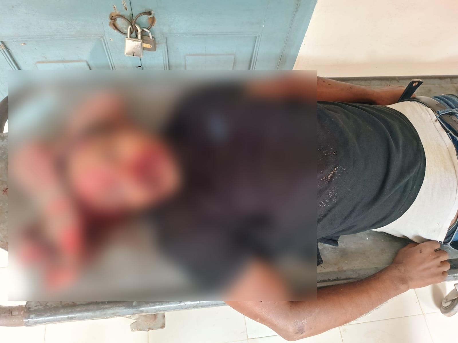 নবাবগঞ্জে গাছের ডাল মাথায় পড়ে মোটরসাইকেল চালক নিহত