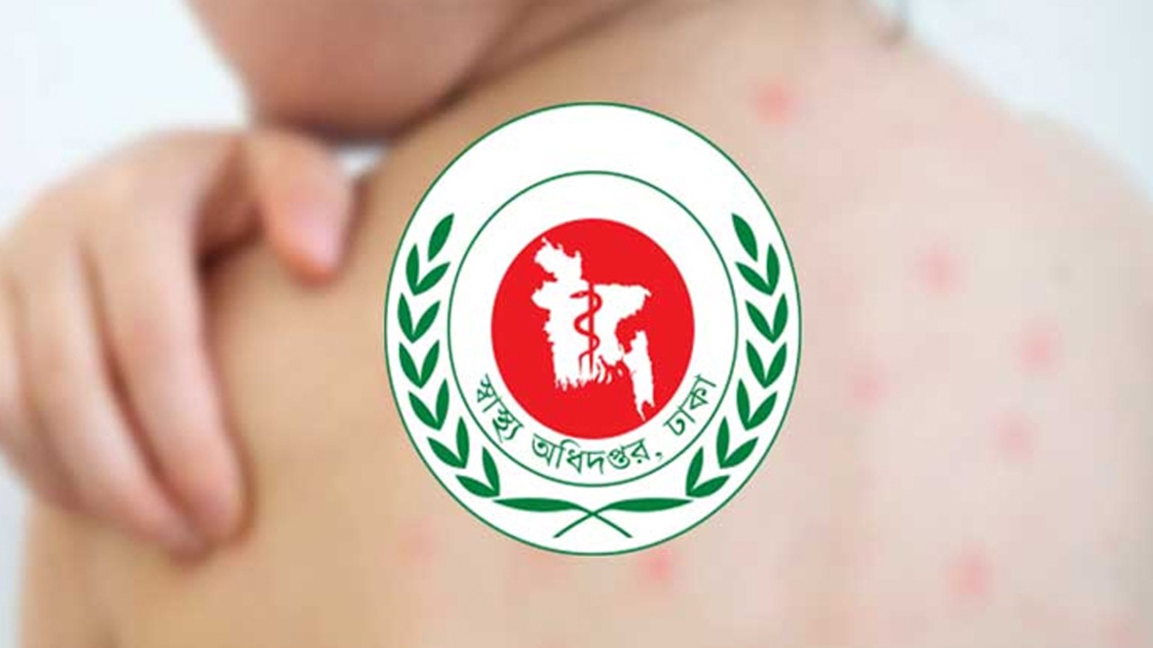 হাম উপসর্গে আরও একজনের মৃত্যু