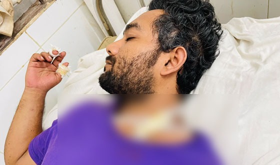 বাবুগঞ্জে সালিশ বৈঠকে হামলার অভিযোগ, আহত ৩