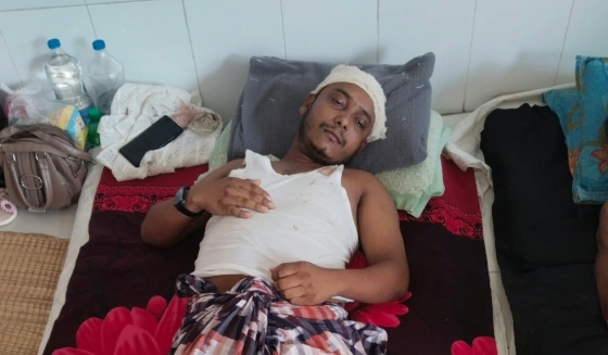 তানোরে এনসিপির নেতাকে কুপিয়ে জখম, ৭ জনের বিরুদ্ধে মামলা