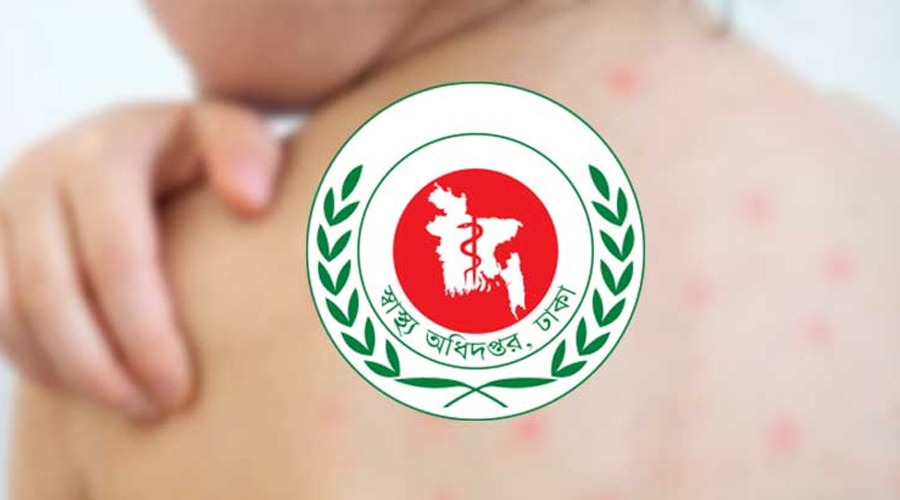 হামের উপসর্গ নিয়ে প্রাণগেল আরও ৩ শিশুর