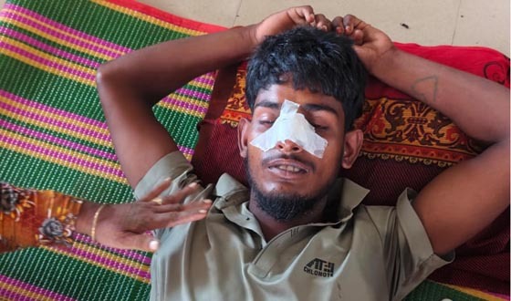 মান্দায় পূর্ব শত্রুতার জেরে যুবককে পিটিয়ে জখম